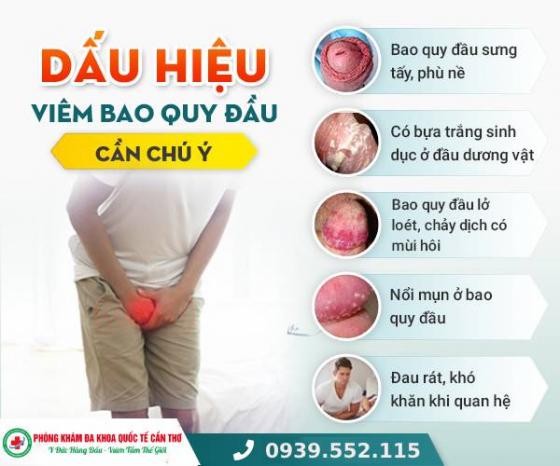 viem-bao-quy-dau.jpg